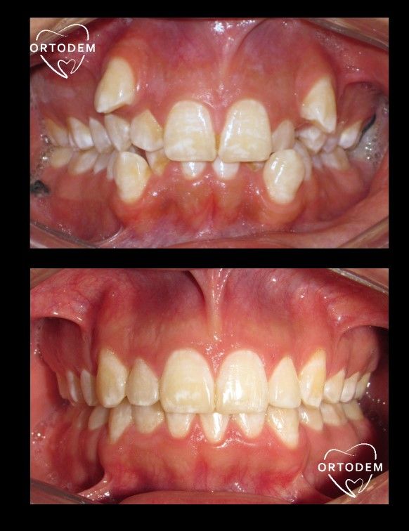 Elizabeth Morelos Morales-2