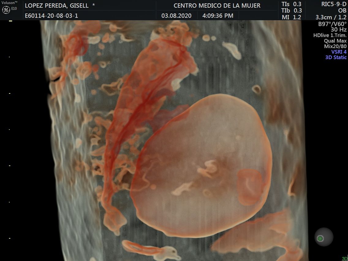 Julio Cesar Monárrez Martín-30