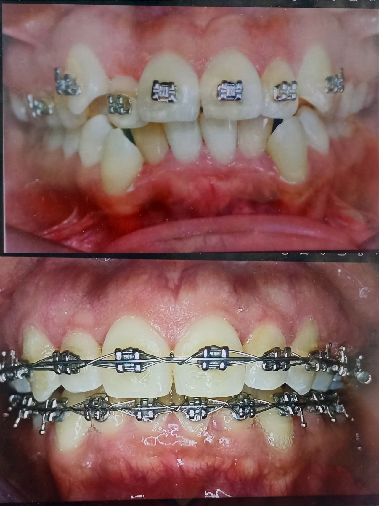 Jair Contreras García-19