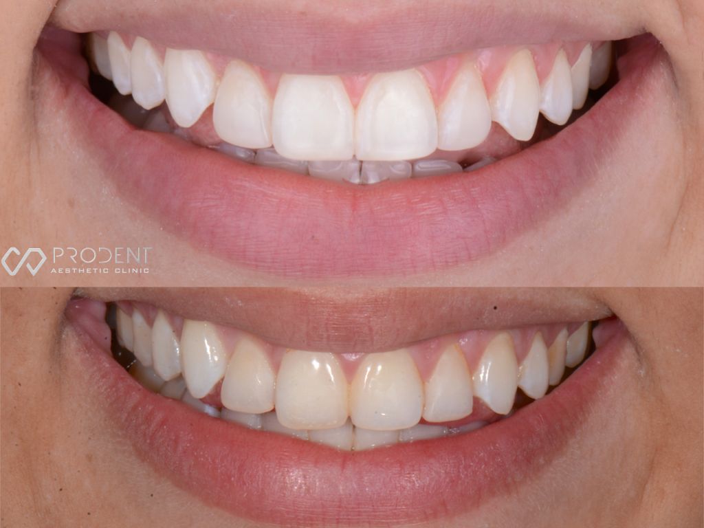 Ulises Pérez Murillo-103