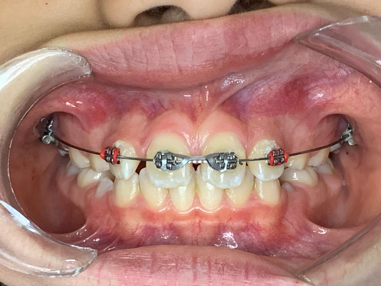 Patricia Rizo Palos-27