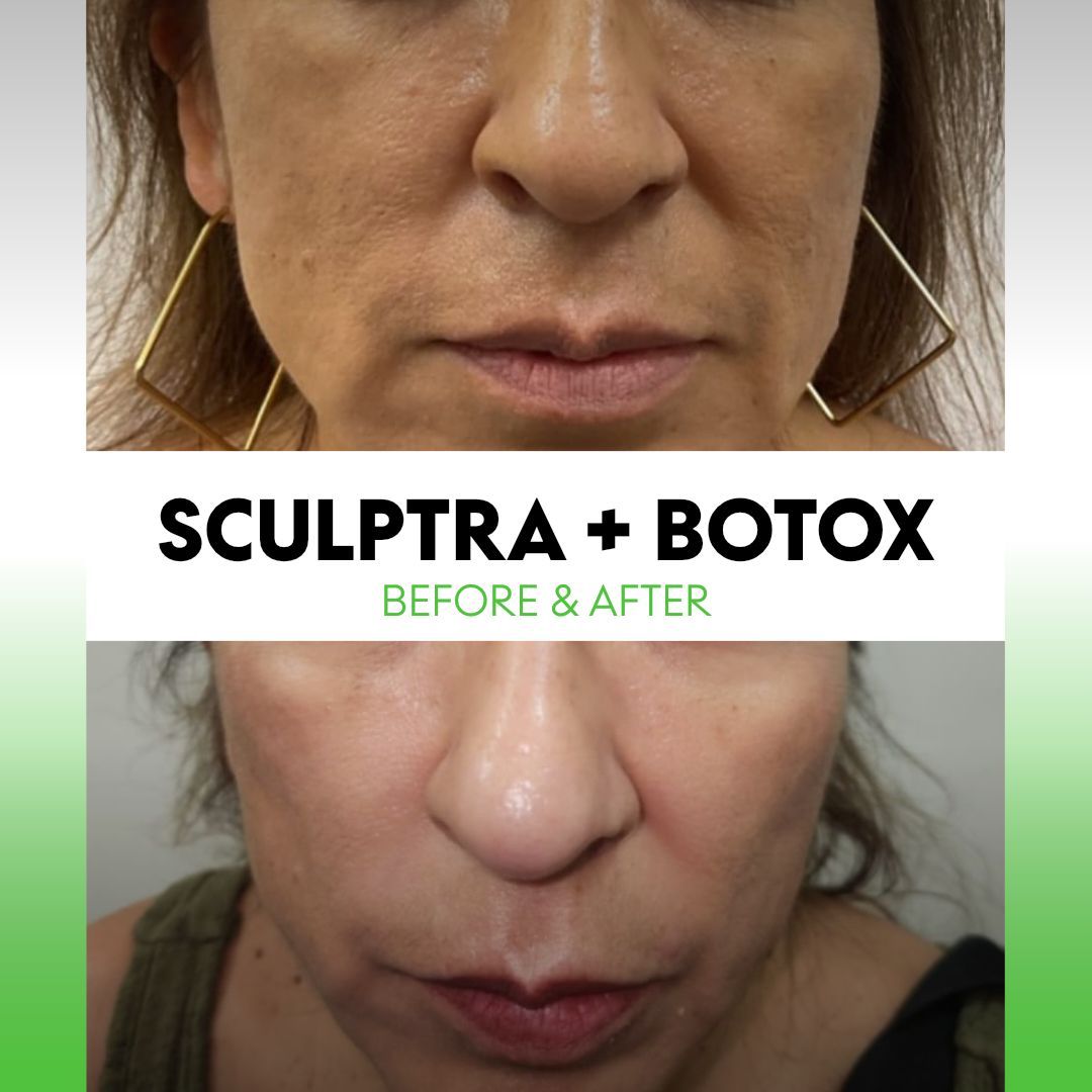 Alejandra Soriano Elorza-116