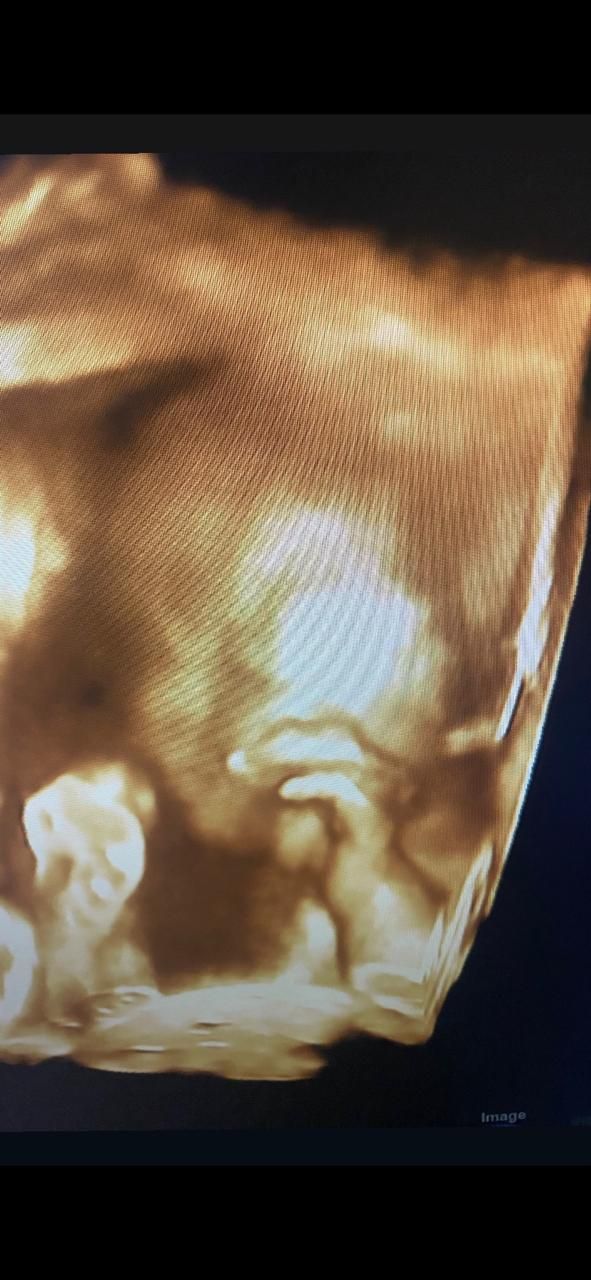 Graciela Elizabeth De La Torre Alvarez-9