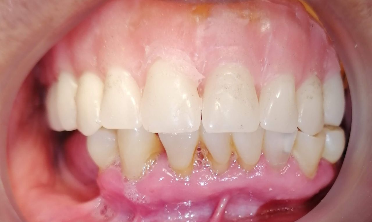 Yaneth Gutiérrez Sánchez-8