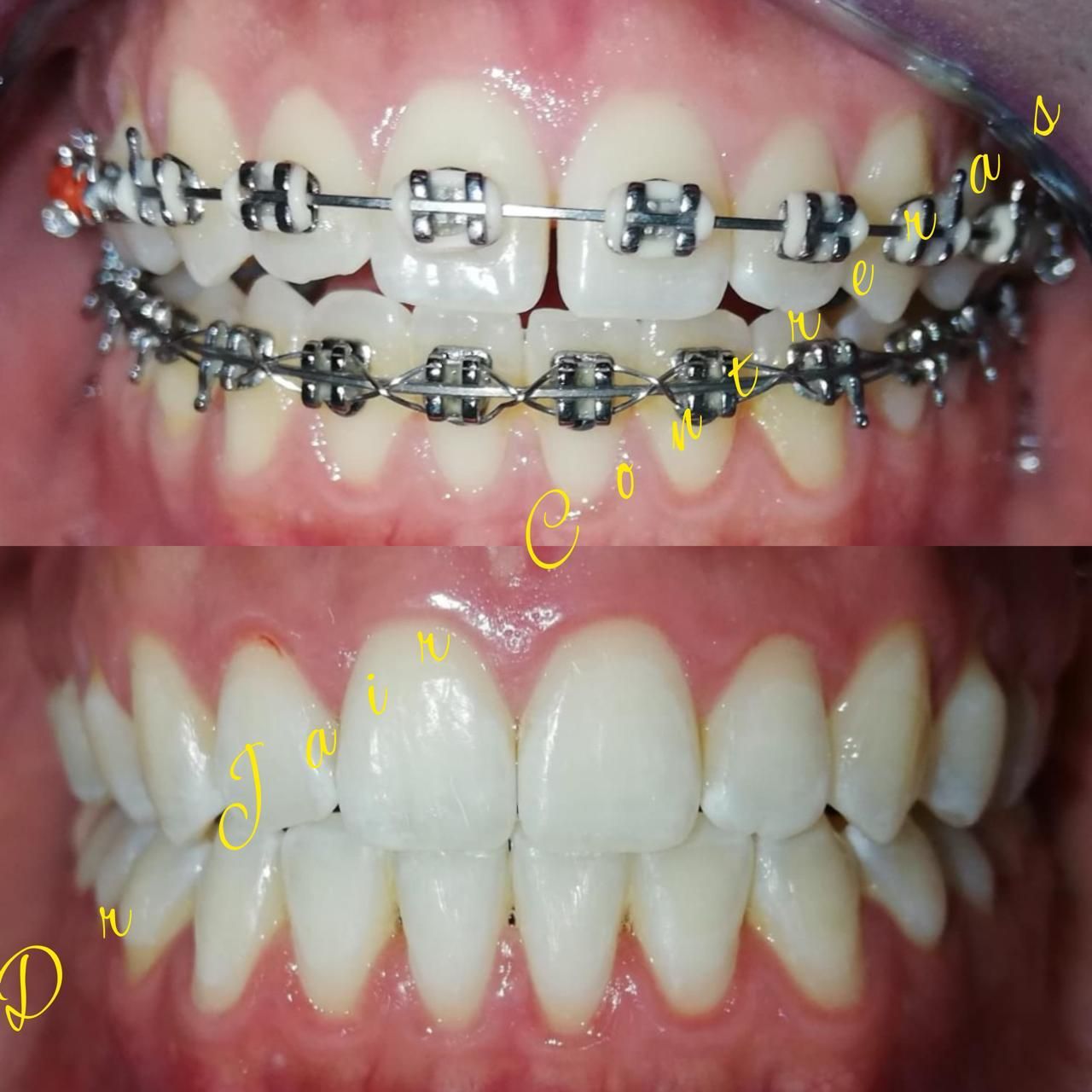 Jair Contreras García-10