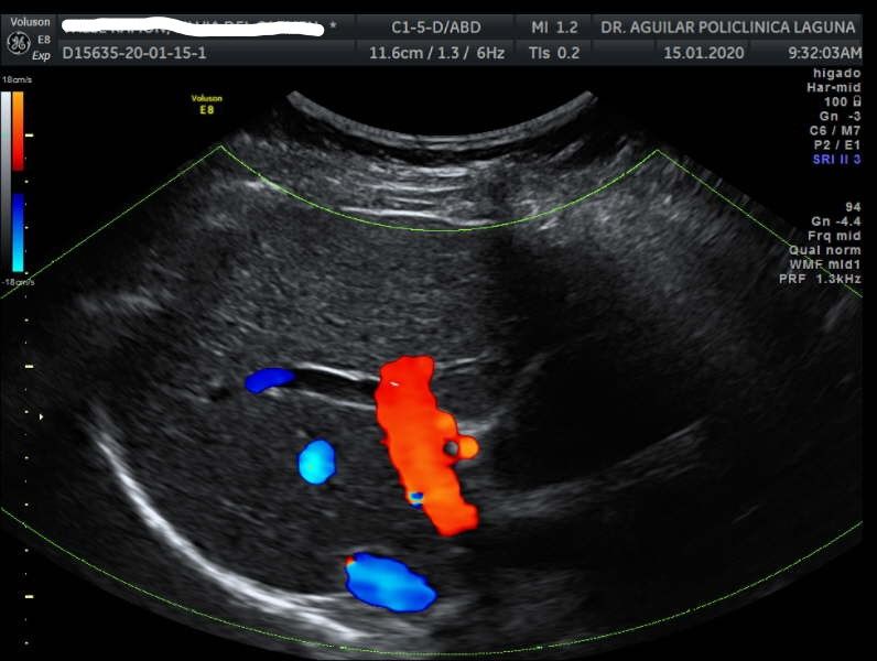 Edgar Fernando Aguilar Morales-15