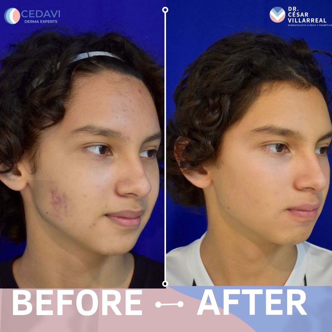 César Daniel Villarreal Villarreal-13