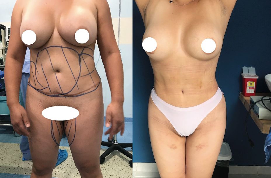 J. Antonio Meré Gómez-11