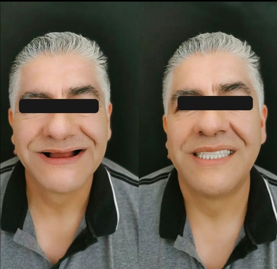 Ana Cecilia Chapa Kindling-10