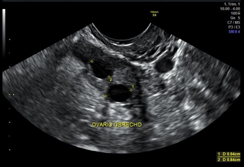 Francisco Alberto Perez Que-7