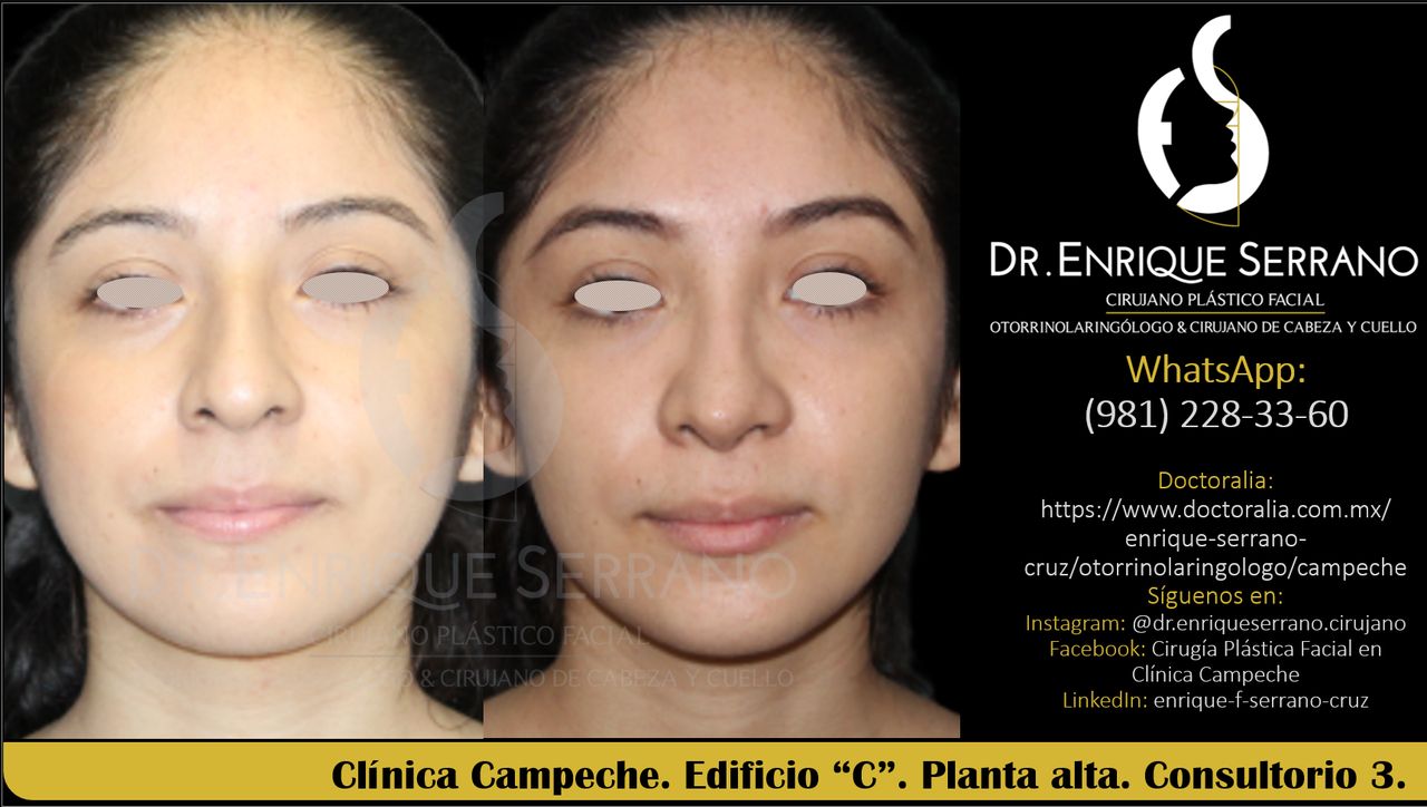 Enrique Serrano Cruz-77