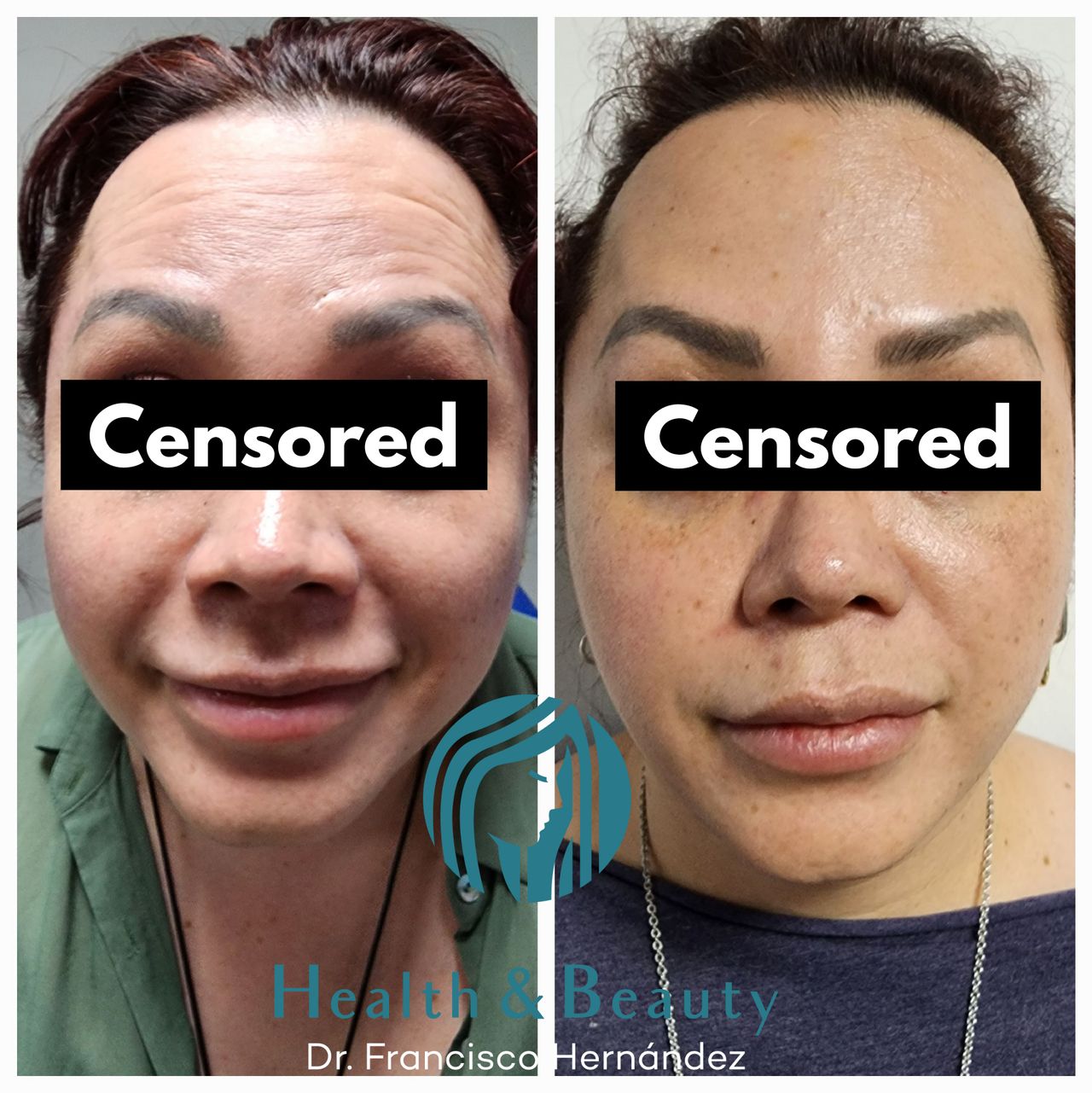 Francisco Hernández Gómez Crespo-63