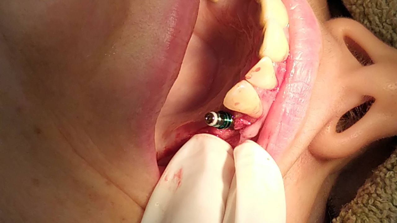 Oscar Cortez Perez-9