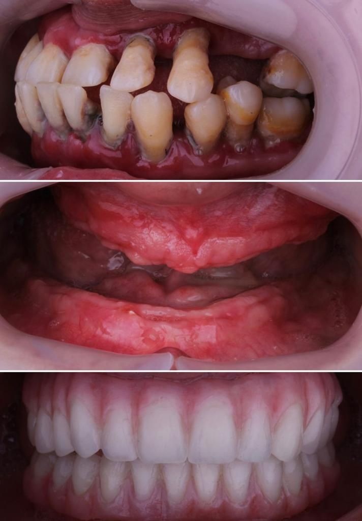 Josué Márquez Gómez-37