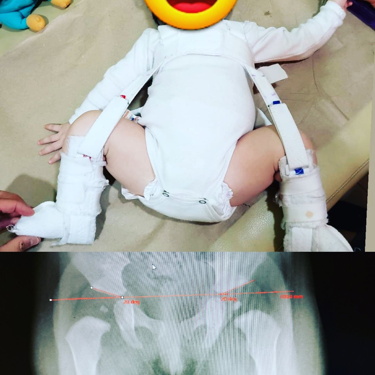 Alfonso Meza Vernis-76