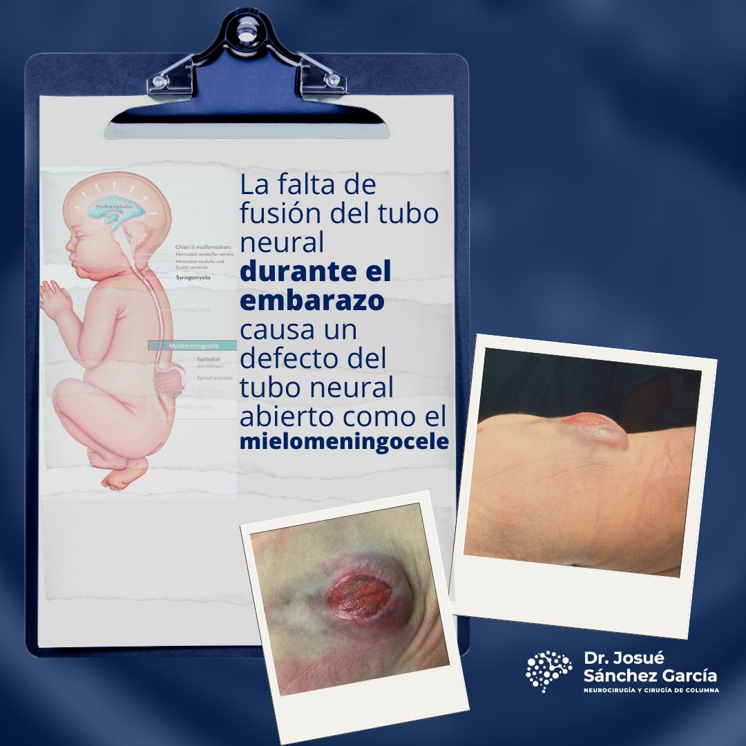 Josué Sánchez García-7