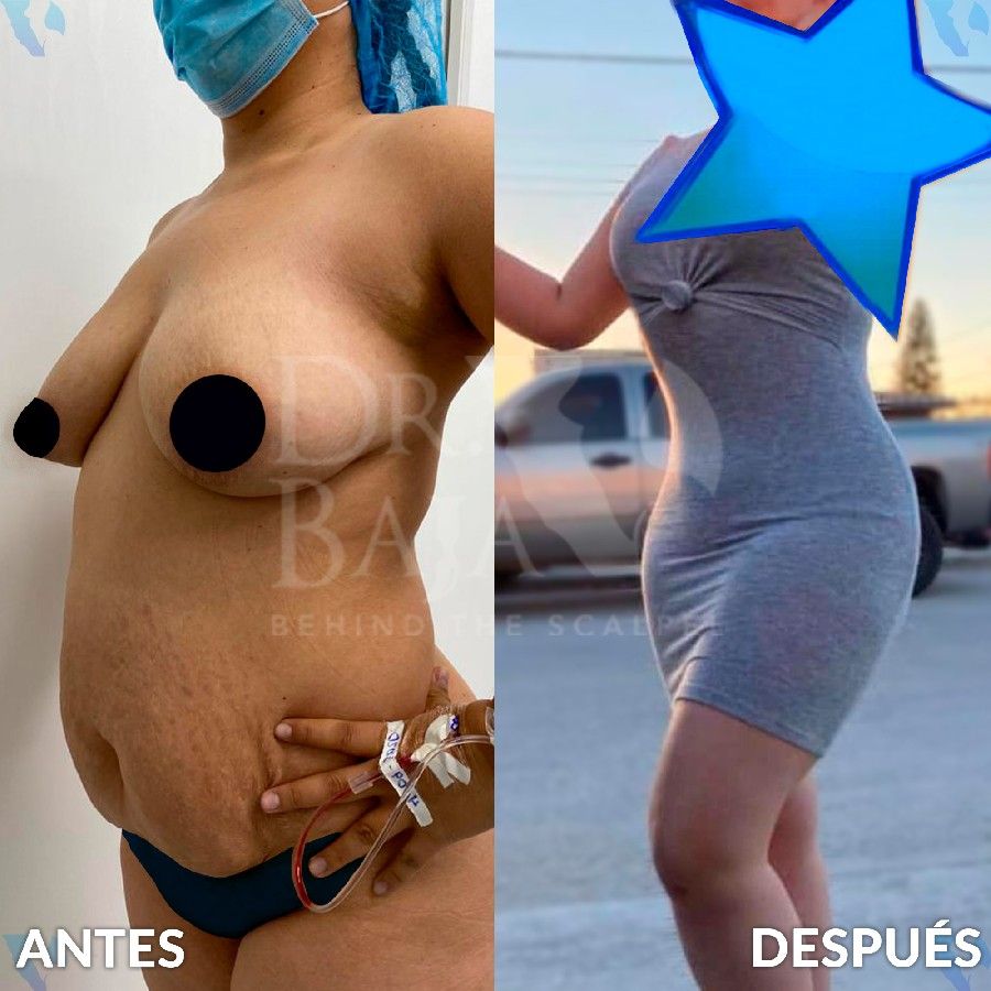 Renato Rodríguez Hirales-4