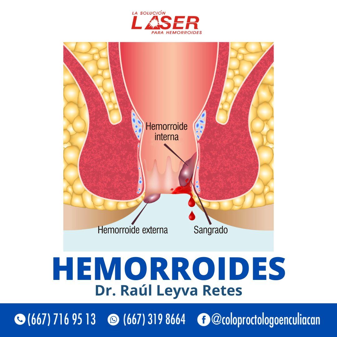 Jesus Raul Leyva Retes-4