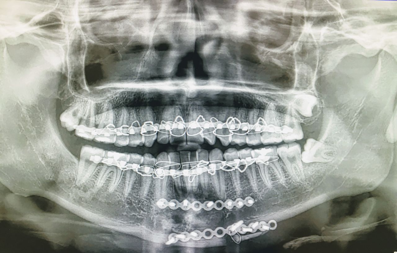 Juan José Castro Mosqueda-4