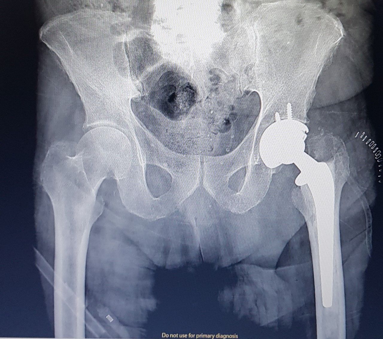 Gilberto Hernández Ortega-45