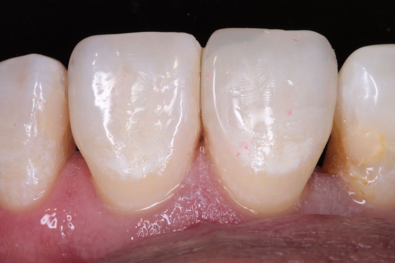 David Alan Escamilla Álvarez-17