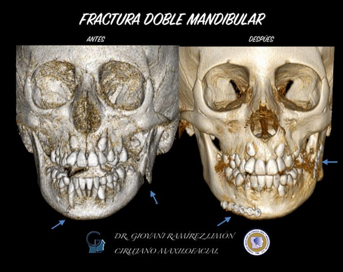 Giovani Ramírez Limón-49