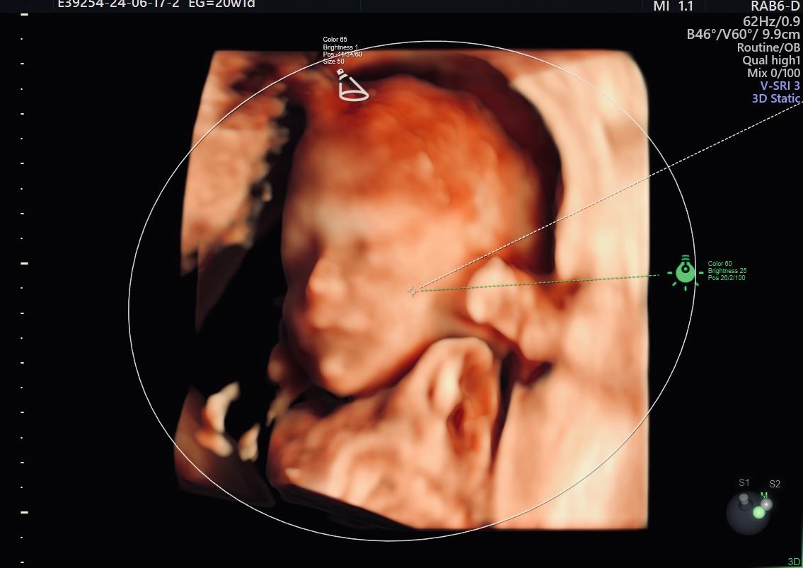 Erik Fernando González Martínez-5