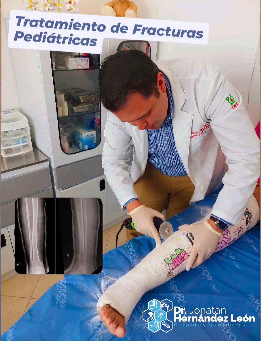 Jonatan Hernández León-32