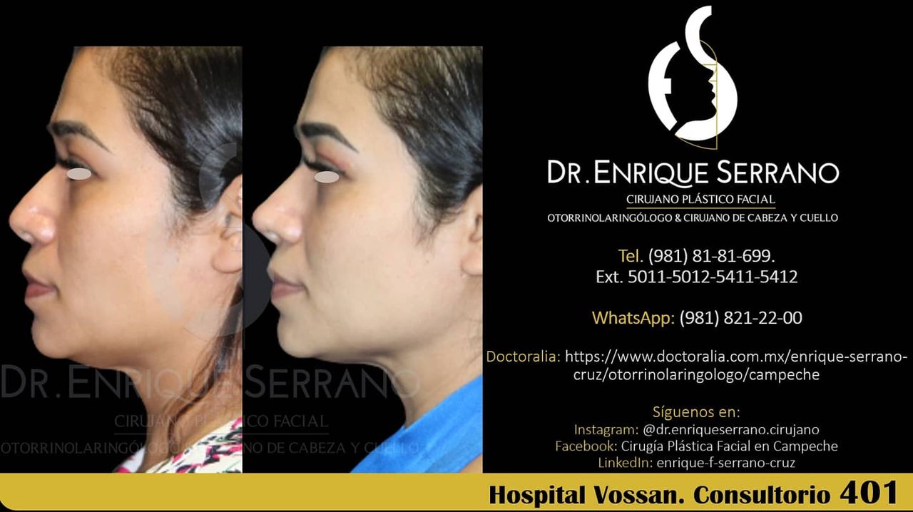 Enrique Serrano Cruz-104