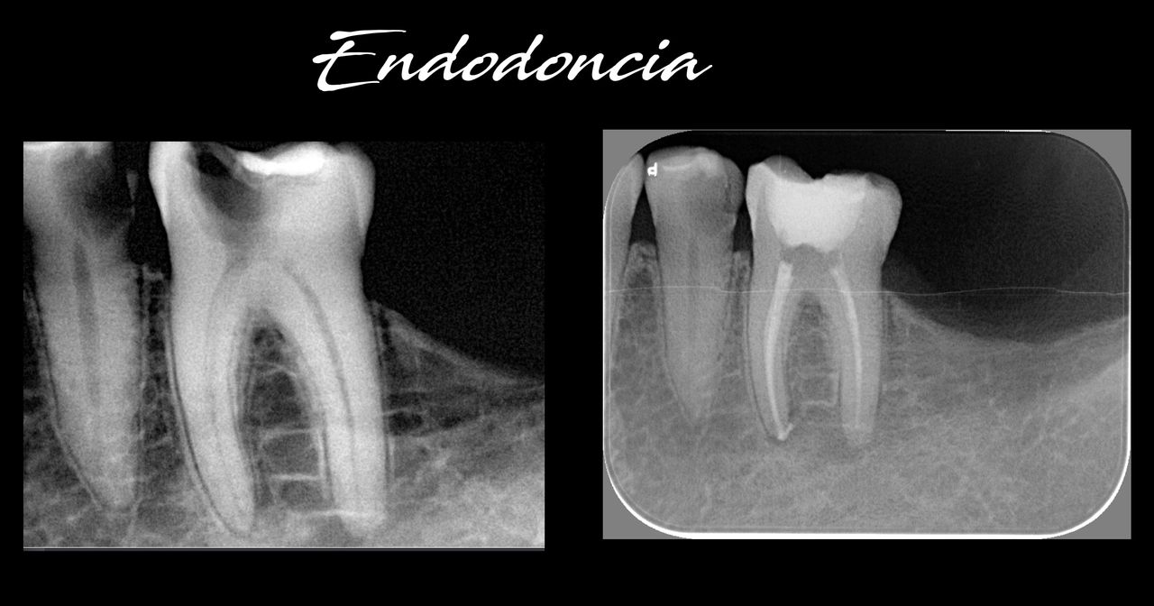 Josué Eli Ortiz López-11