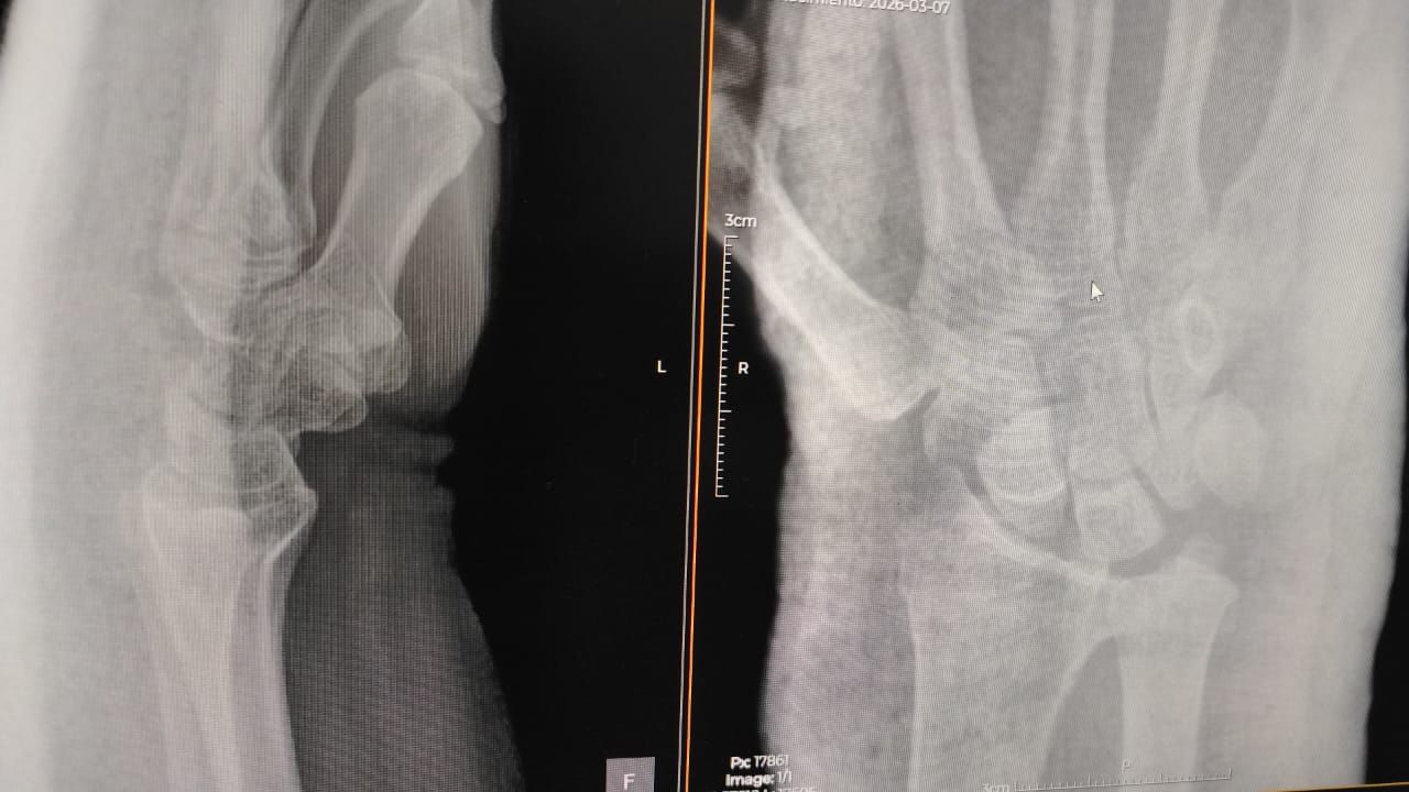 Alejandro Irisson-33