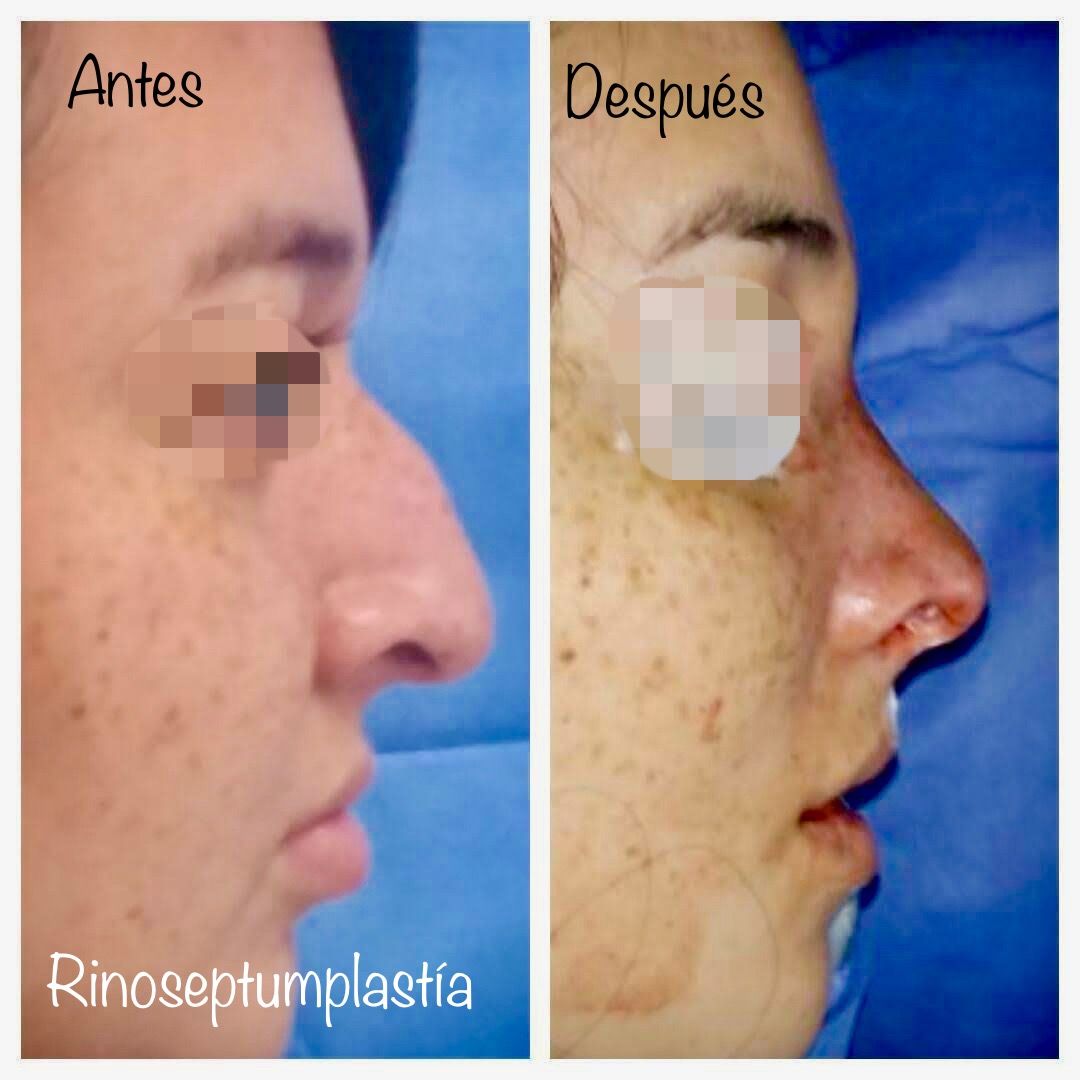 Ana Guadalupe Torres León-0