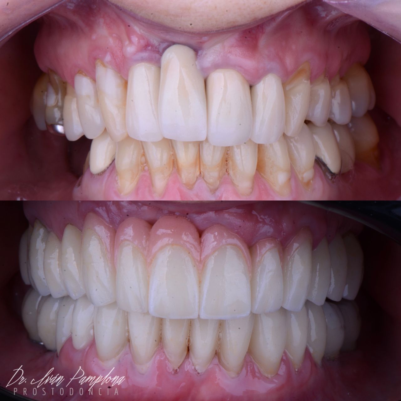 Iván Gerardo Pamplona Alfaro-21