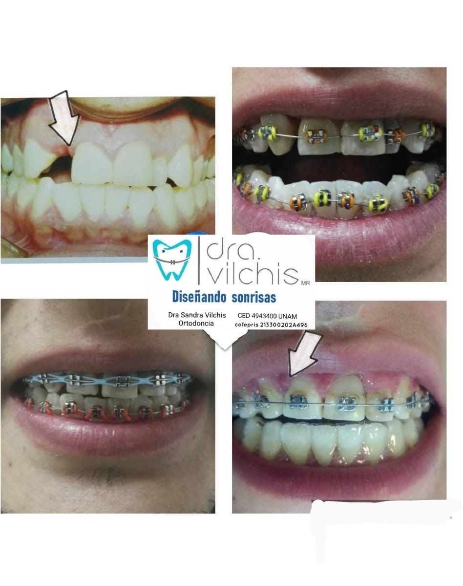 Sandra Vilchis-0