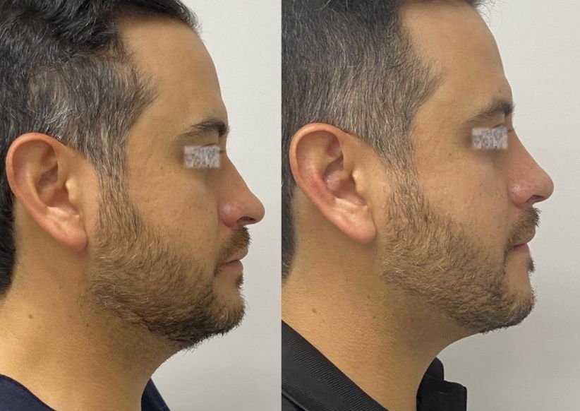 Elsa Sánchez Robles-20