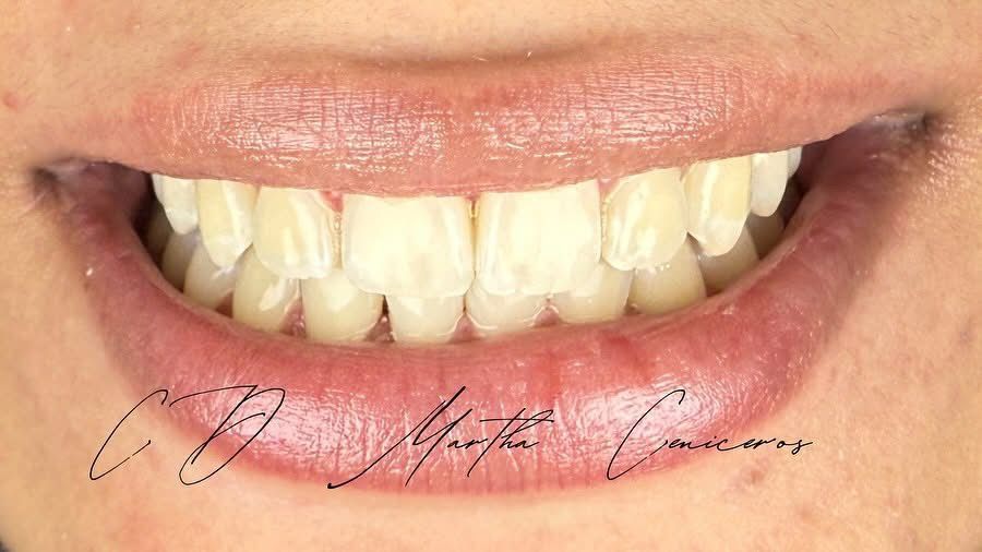 Martha Alicia Ceniceros Betancourt-23