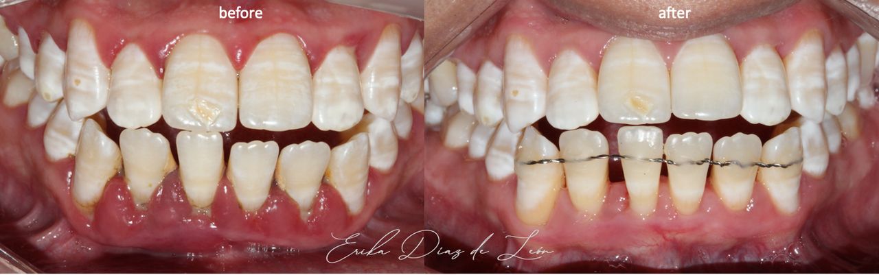 Erika Díaz De León Torres-5