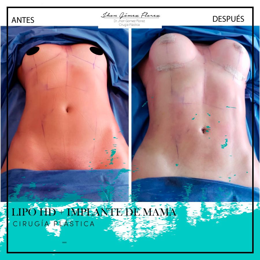 Jhon César Gómez Florez-52