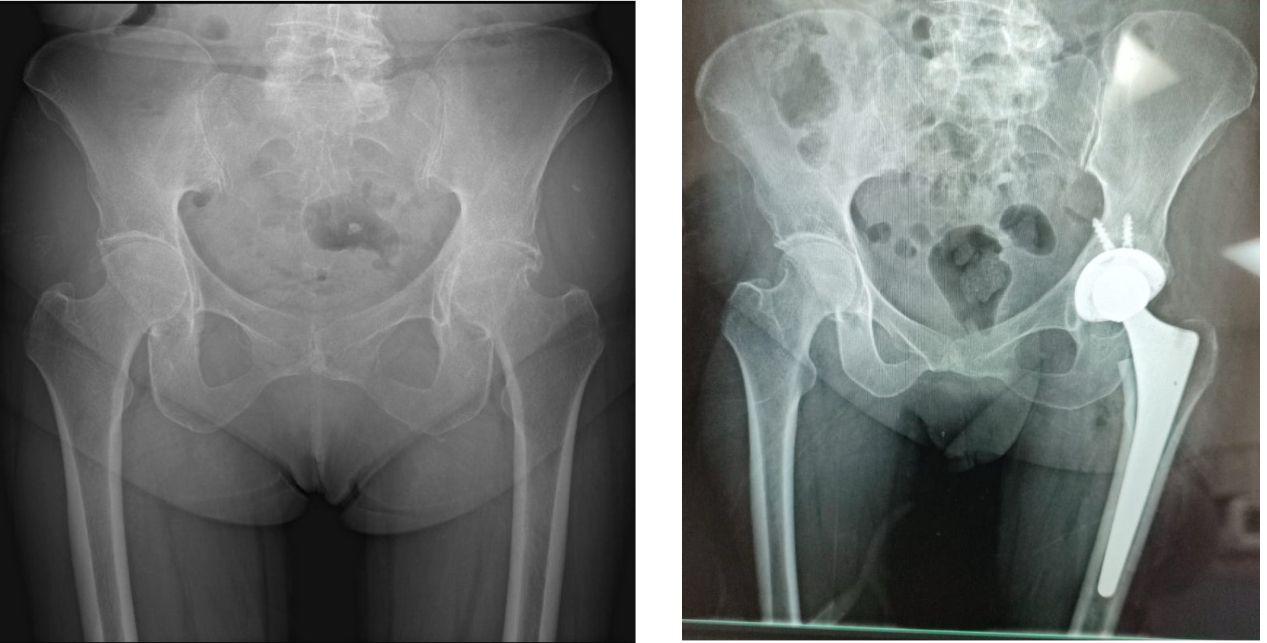 Carlos Tapia Hernández-5