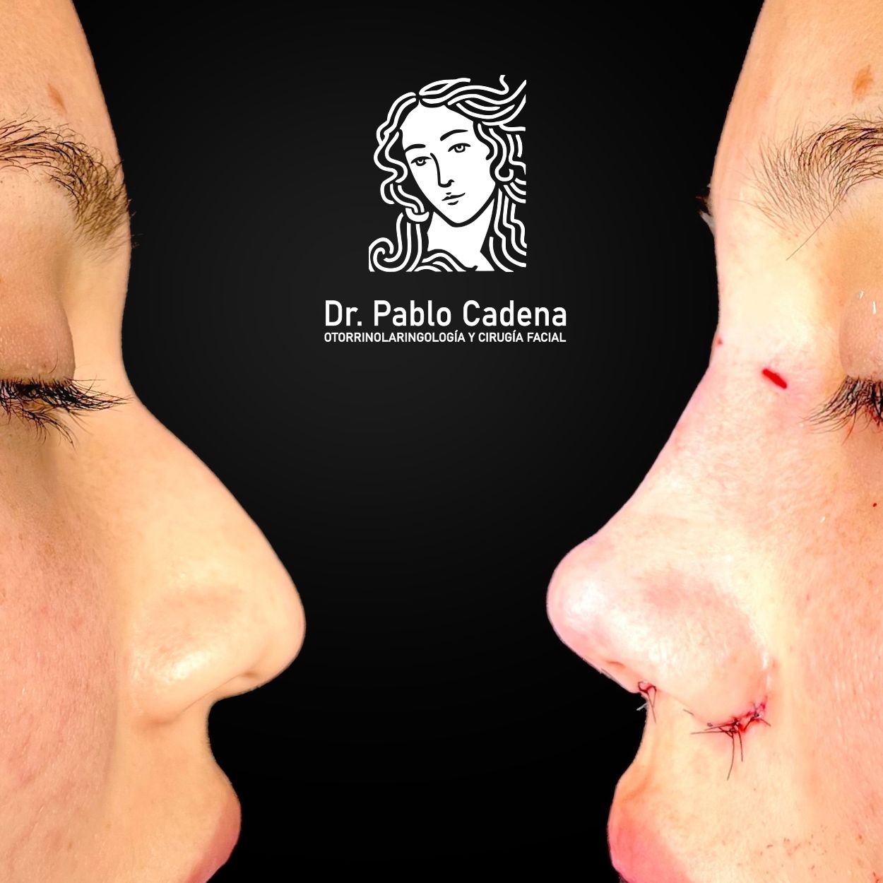 Juan Pablo Cadena Calderón-8