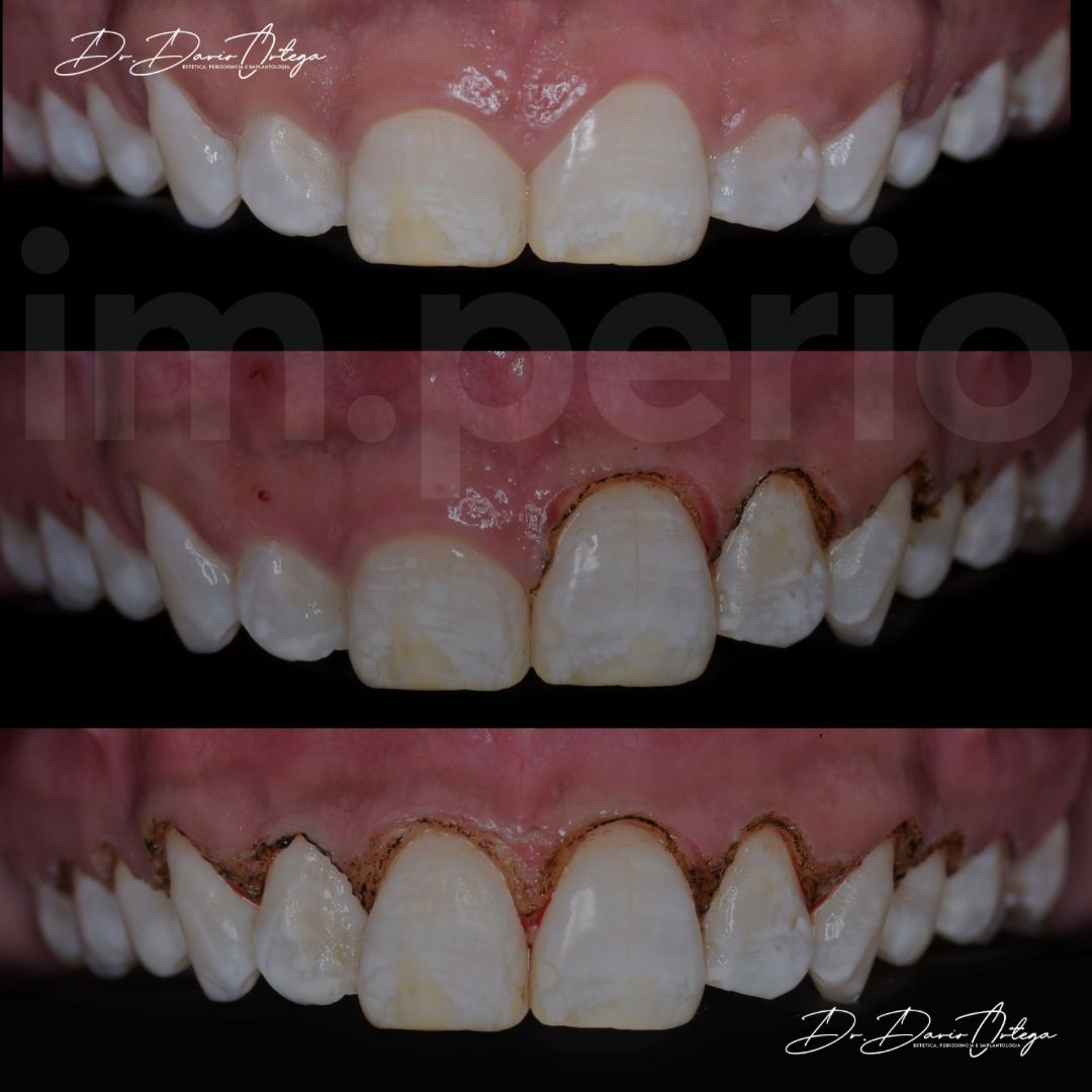 Dario Ortega Aceves-30