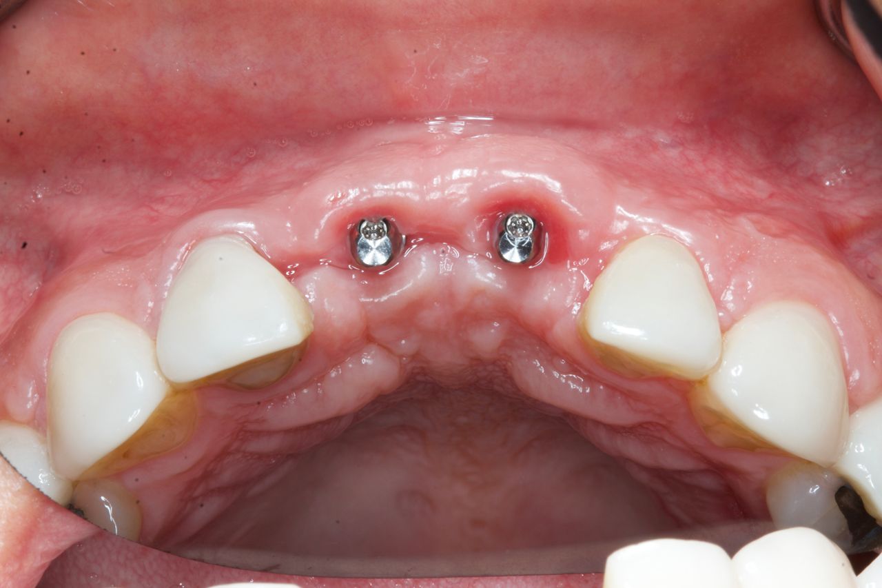 Agustin Salamanca Tapia-5