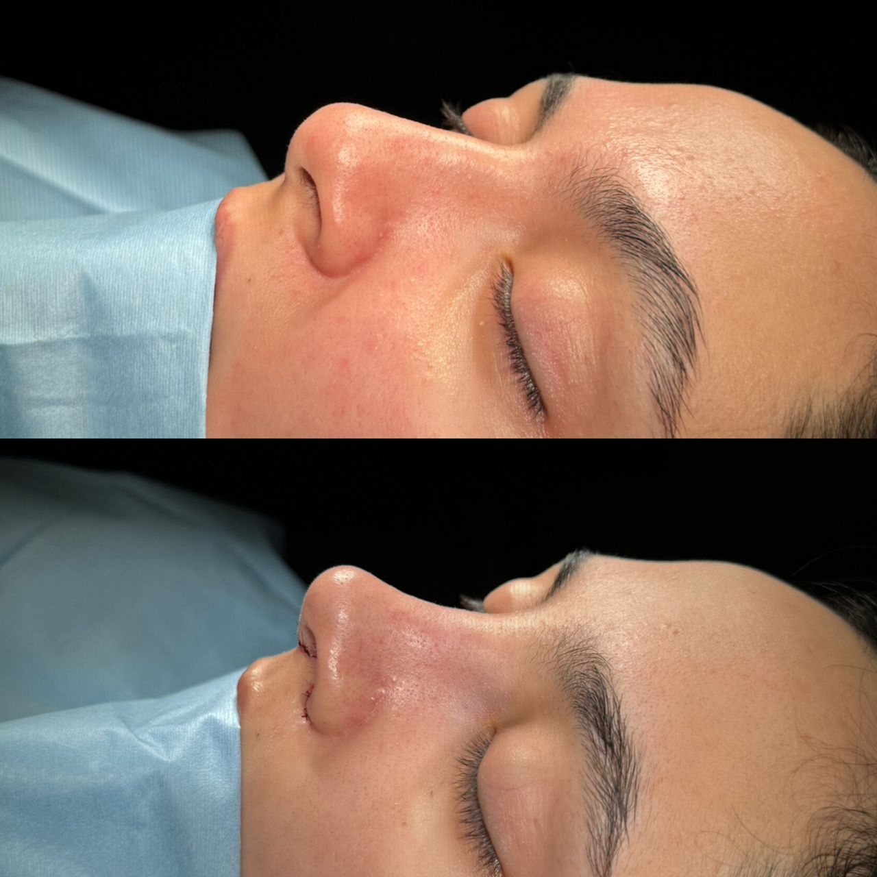 Angel Castro Urquizo-152