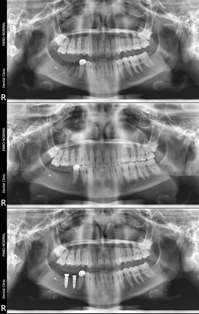 Carlos Ernesto Contreras Castellanos-23