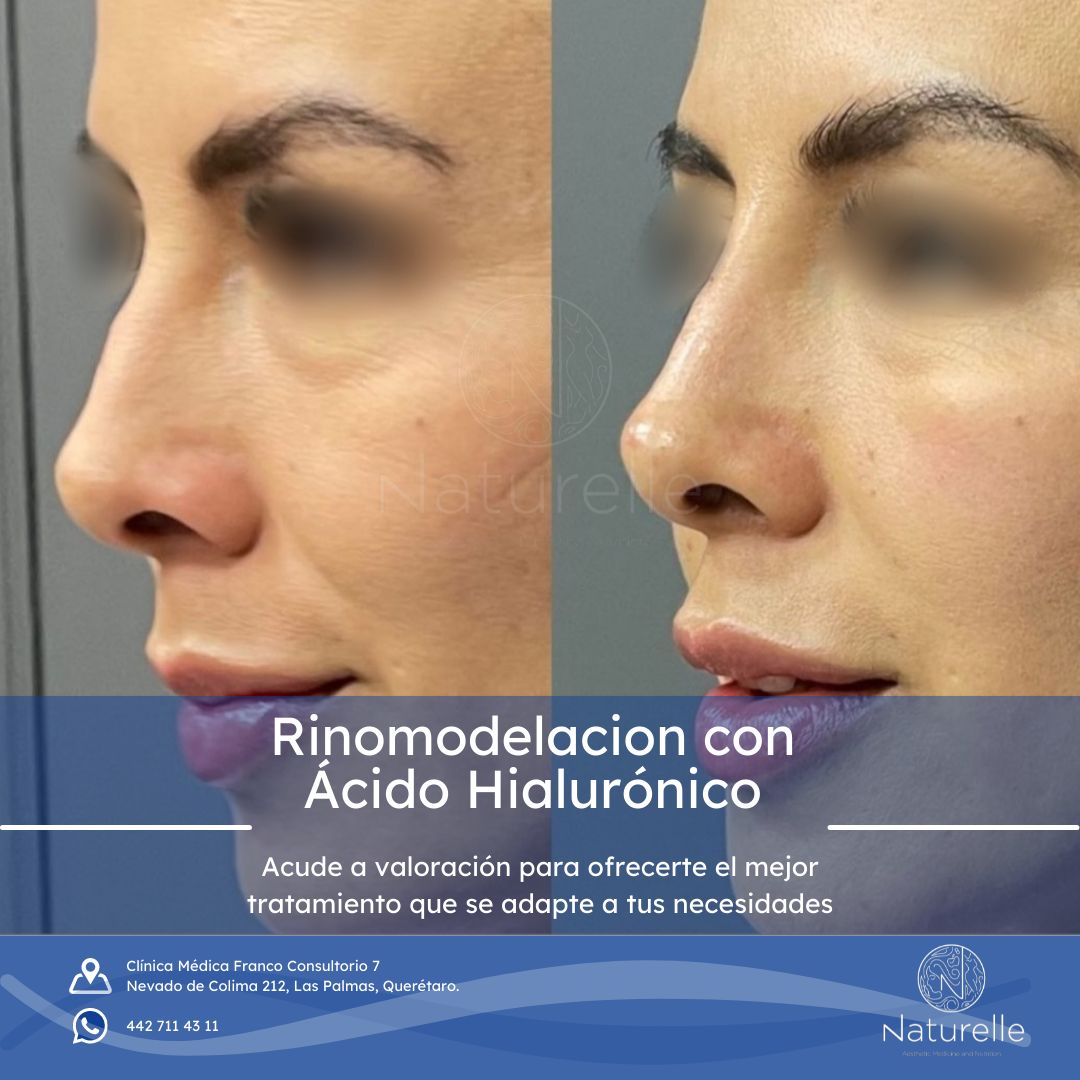 Daniel Marín Jasso-25