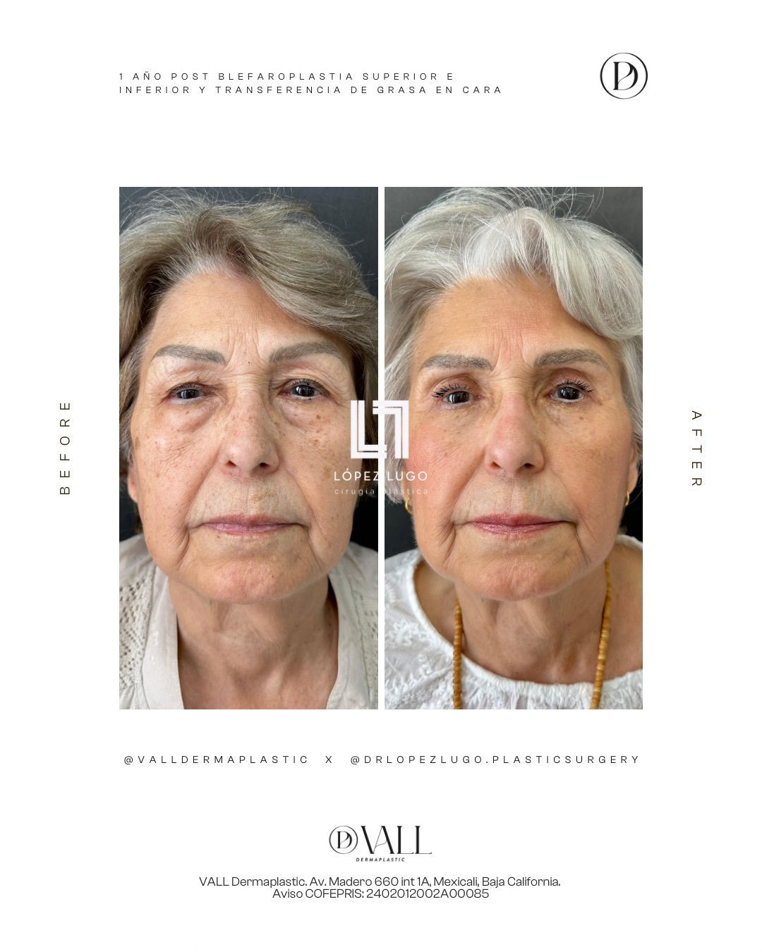 Omar Federico López Lugo-26