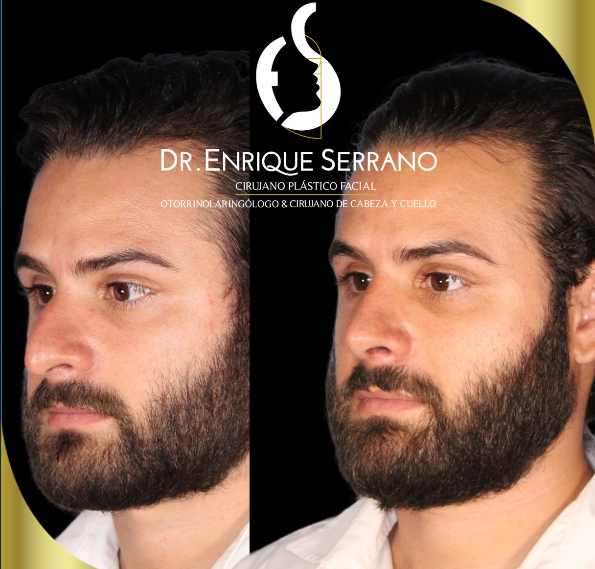 Enrique Serrano Cruz-3