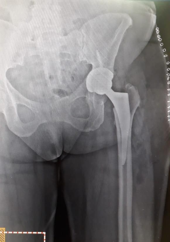 Jhon Jairo Galvis Bermudez-38