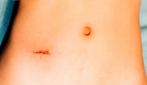 Iván Nájera Ayuso-39