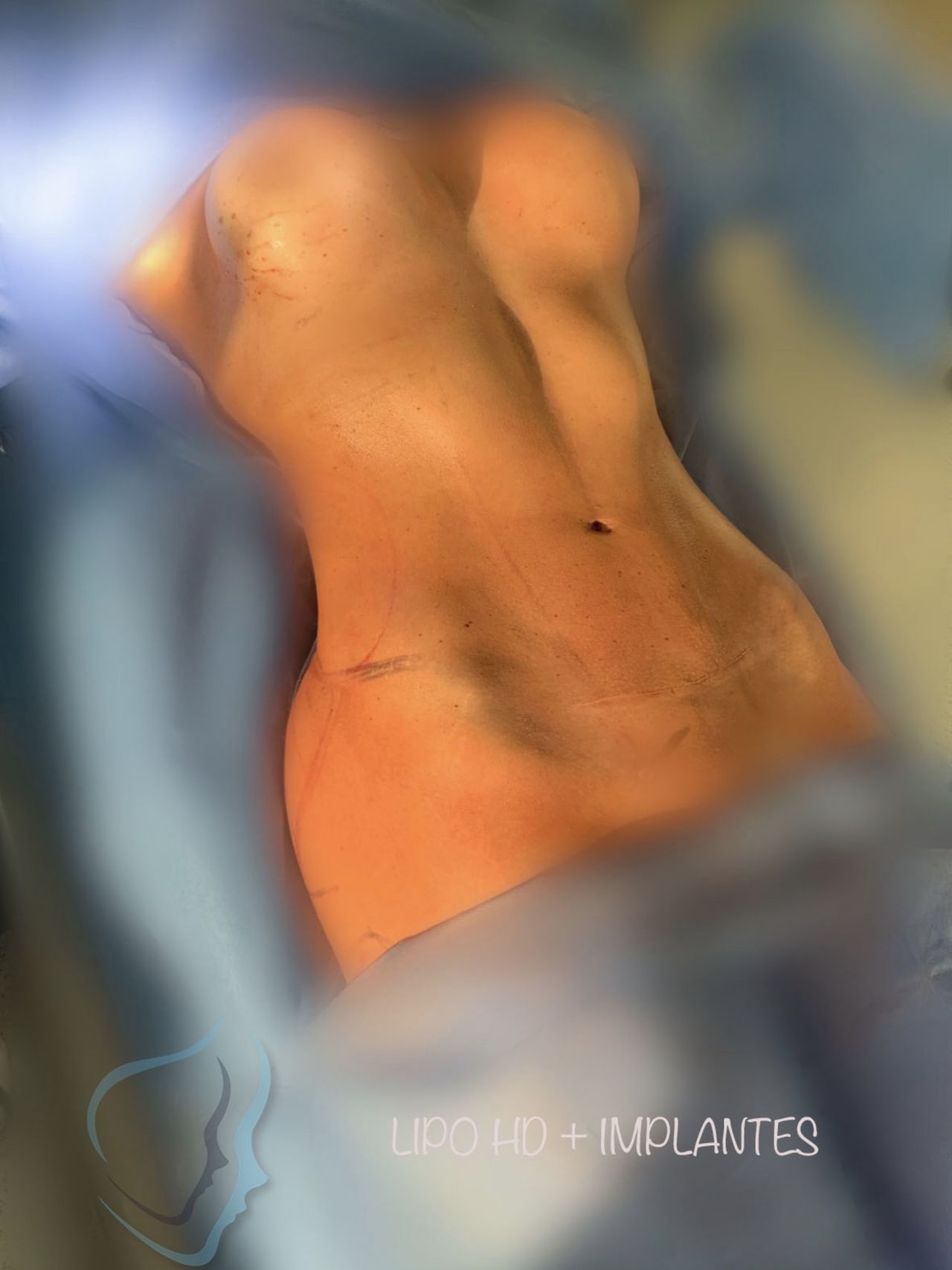 Giuseppe Tanzillo-28